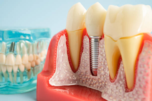 Best Dental Exams and Cleanings  in Meron Park, CA